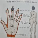 수지침 이미지
