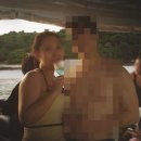 멍빨래 | 논현지방흡입 팔뚝지방흡입 2주차 통증,멍,붓기 후기 로트지방흡입