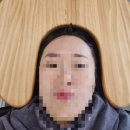 1332 | 달서구두피관리 스켈프 302에비뉴 용산본점 후기