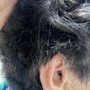 시그니아독일보청기 관악센터 이미지