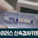 노로바이러스 검사 방법 장염의 원인 이미지