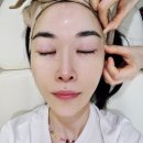 부산 덕천피부과 재방문! 쥬베룩볼륨 2차 후기: 건강한 피부 볼륨과 탄력의 비밀을 찾아서