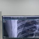 장병두정형외과의원 네이버블로그