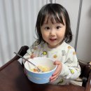 세브란스안경 | 용인세브란스병원 5세 유아 내사시 수술 후기