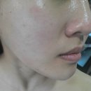 삼정그린코아더베스트 101동 앞(명지동 3599-3) | 부산강서구피부관리 제대로 찾았다! 리프팅 윤곽케어 맛집 : 브브스 스킨 스파