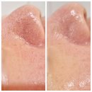 씨유 강선14단지 | 일산 주엽 피부관리 라인피부관리실에서 모공 홍조 진정관리 후기(모공풀케어)