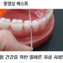 치아의 날, 치실만 잘써도 충치와 잇몸병 절반이상 예방할 수 있다??!! 이미지