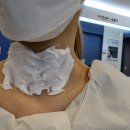 남문석내과의원 | 갑상선 결절 조직검사 후기 ..그리고 양성 판정!