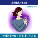 [관절수술정보] 어깨회전근개파열 초기에 잡으면 관절내시경 받지 않을수도 있어요! 이미지