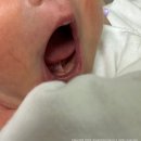 정소아과의원 | (육아) 청주 신생아 설소대 시술 &amp; BCG피내용 이영두소아과후기