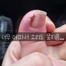 남과여미용실 | [30대유방암] 2024년10월 _ 유방암3기 / 버제니오 복용 일상 / 버제니오 증상 기록 / 젤로다 부작용...
