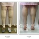 웰빙포유