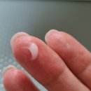 옥길온누리약국 | 여드름 흉터는 내돈내산 노스카나로 관리하고 있어요