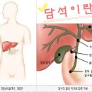 모두들 아실만한 커피가 담석예방 에 도움을 준다 이미지