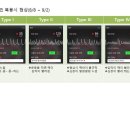 발작성심방세동_시술전경과 이미지