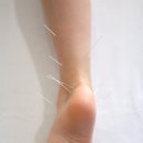 우아한방병원 이미지