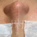 무리바 케어 이미지