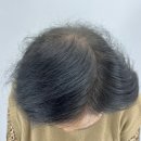 픽스칼프 이미지