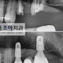 서울조아치과 이미지