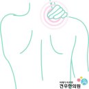 [손저림] 지긋지긋한 손저림, 유독 나에게만 잘 생기는 이유는? 이미지