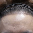 압구정모비앙의원 이미지