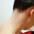 남영역 습진 한의원 잠부터 고치기