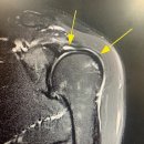 어깨사랑마취통증의학과의원 이미지