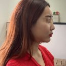 제이와이메디칼 이미지