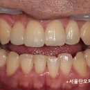 최강치과기공소 이미지