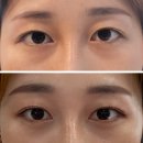 영앤유스