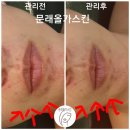 화이트테라피