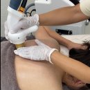 예봄인테리어 | 예봄뷰티 테라노바 승모근 관리 후기