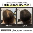 블랙인스칼프 | 대구두피문신 당당해졌어요