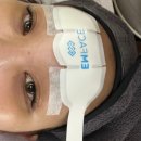강남고속터미널 피부과 엠페이스 받아본 후기 통증 전혀 없는 리프팅