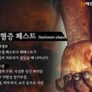 흑사병 원인 증상 흑사병 전염 치료 중국 흑사병 마스크 흑사병 예방법 이미지