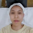 협신전기 | [서면피부관리] 부산스킨플래닝 잘하는 <블랑미> 후기