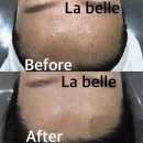 라 벨르 에스테틱 이미지