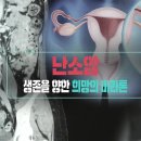 [876회] 생로병사의 비밀/난소암, 생존을 향한 희망의 마라톤 이미지