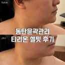 동탄윤곽관리 두피부터 목 어깨까지 관리해주는 온유어에스테틱 티리온 셀핏 후기