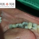 3day치과기공소 이미지