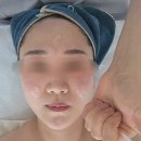 청주 동남지구 윤곽관리, LDM까지 해주는데 12만원? 온유에스테틱 소프트윤곽관리 솔직후기