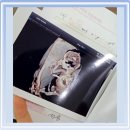 아기 15주차 2차 기형아 검사 후기(군산 양지산부인과)