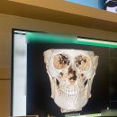 오호성형외과의원 | 강남 성형외과 사각턱 수술 잘하는 곳 안면윤곽 상담 후기