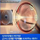 란안경원 | 부산 초고도근시 난시 안경 S-12.25 C-5.50 중학생 시력검사 전문 부산대 윙크안경원