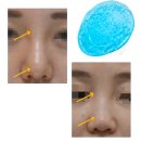 바비코 코시술 후기 사진에 속지 마세요.