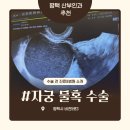 지엔(GN)헬스케어 | 자궁 물혹 수술 전 진료 후기① 평택 지엔gn산부인과