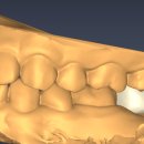 나노치과기공소 이미지