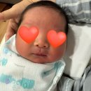 프라임어린이집 | 짱동이 출산3일차 후기!(둘째출산, 제왕3일차, 삼성프라임산부인과)