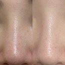 Laser Wash (레이저워시) | 대구 피부과 안 가고 피부 좋아진 이유 | 에스테틱 전용 화장품 ‘바이더퀄리티’ 전 제품 솔직 리뷰...