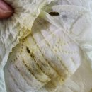 파랑새의원 | 서울 은평구 영유아 1차검진 BCG 경피형 가격과 접종 후기